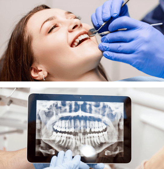 Dentist working on a patient's teeth from their x-rays.